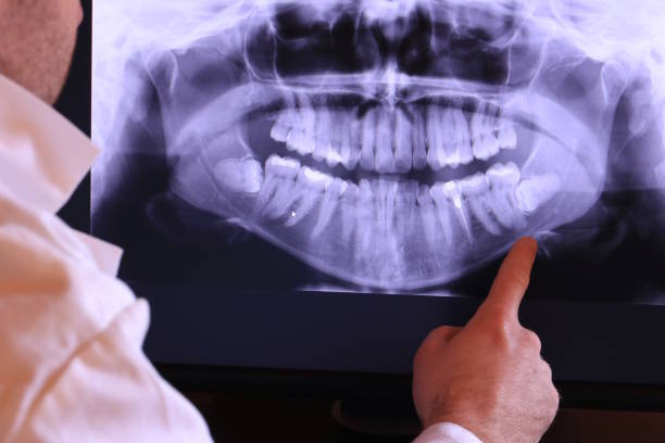 Best Emergency Tooth Extraction  in Franklin Furnace, OH