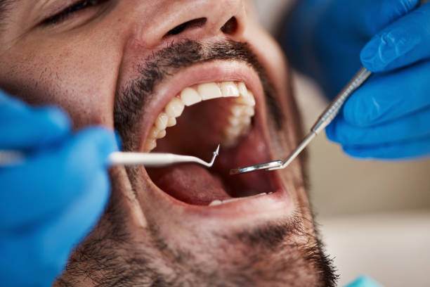 Best Urgent Tooth Repair  in Franklin Furnace, OH