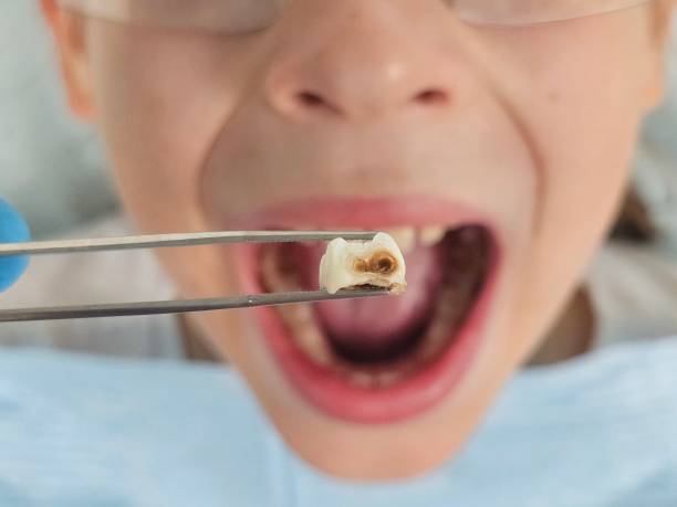 Best Broken Tooth Emergency  in Franklin Furnace, OH